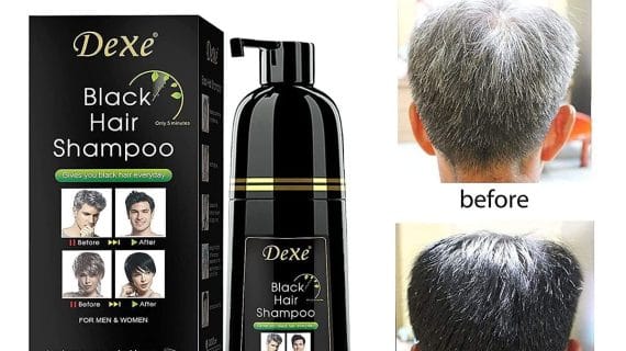 (৪০০ML হার্বাল শেম্পু)Dexe Fast Black Hair Shampoo