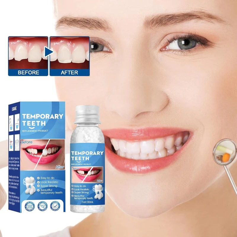 Temporary Moldable Tooth Repair Kit-30ml